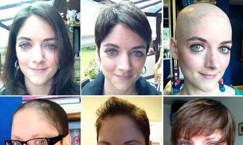 My hair journey after chemotherapy Laura Price, Hair Growth After Chemo, Hair Growth Charts, Become Beautiful, Hair Growth Women, Castor Oil For Hair Growth, Chemo Hair, Timelapse Video, Hair Mask For Growth