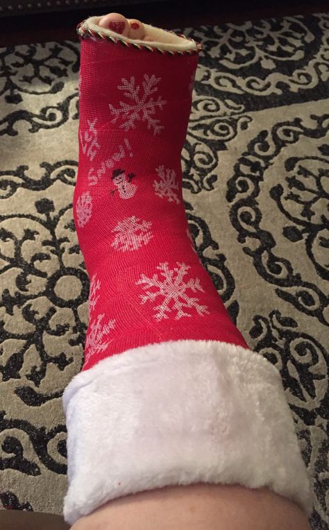 Cast Decorated if I must wear this during the holidays 🎄 Cast Ideas Leg, Cast Decorating Ideas Leg, Broken Hand Cast, Crutches Padding Diy, Broken Ankle Cast, Ankle Cast, Crutch Pad, Kids Cast, Cast Decoration