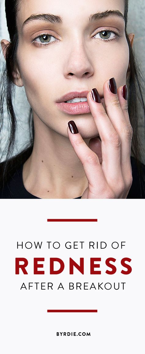 How to get rid of redness after a breakout Red Spots On Face, Back Acne Remedies, Face Diy, Acne Overnight, Acne Face Wash, Spots On Face, Acne Solutions, All Natural Skin Care, How To Get Rid Of Acne