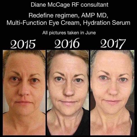 Rodan + Fields = Anti- Aging POWERHOUSE!!! REDEFINE is R + F's anti-aging skincare line, and these results show why it is a game changer!!! Are you ready to fight back against wrinkles, fine lines, and aging skin? #messageme Rodan Fields Skin Care, Turn Down For What, Redefine Regimen, Rodan And Fields Redefine, Aging Backwards, Life Changing Skincare, Acne Cleansers, Anti Aging Wrinkles, Anti Aging Tips