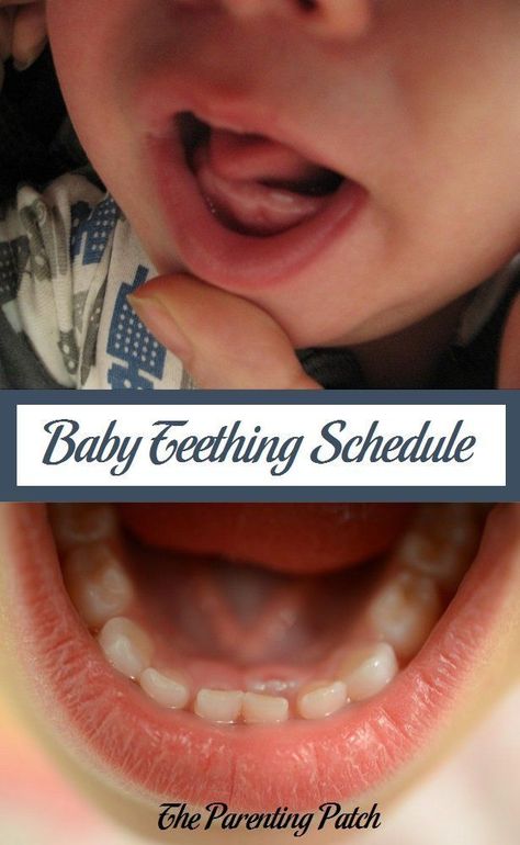 Learn about the approximate order in which primary, or baby, teeth erupt. 10 Month Milestones Baby, 2 Year Molars, Teeth Eruption Chart, Baby Tooth Chart, Colic Remedies, Teething Chart, Tooth Brushing Chart, Baby Items List, Teeth Eruption