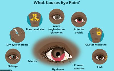 Eye Medicine, Computer Vision Syndrome, Eye Pain, Blurry Vision, Sore Eyes, Light Sensitivity, Vision Problems, Natural Cold Remedies, Eyes Problems