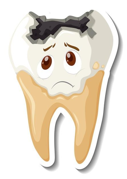 Tooth Decay Cartoon, Decayed Tooth, Teeth Decay, Tooth Caries, Cartoon Teeth, Teeth Drawing, Tooth Cartoon, Tooth Cavity, Dental Decay