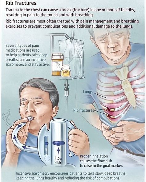 Nursing Pharmacology, Nursing Leadership, Nurse Study Notes, Nursing Mnemonics, Nursing Student Tips, Surgical Nursing, Medical Surgical Nursing, Medical Student Study, Pharmacology Nursing