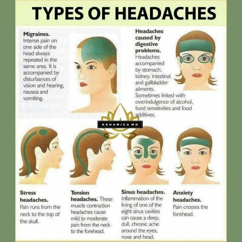 Type Of Headaches 🕵🏾‍♂️📖🕵🏾‍♂️ Did You Know? . TAG-SAVE-SHARE with someone that needs to see this . If you identify the type of headache you… Sinus Headache Remedies, Type Of Headache, Headache Relief Essential Oils, Natural Migraine Relief, Sinus Cavities, Oils For Sinus, Headache Causes, Headache Types, Sinus Headache