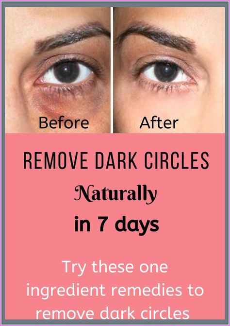 Remove Dark Circles, Under Eyes, Dark Circles Under Eyes, Creating A Newsletter, Years Younger, Health And Fitness Tips, Dry Brushing, Health Remedies, Dark Circles