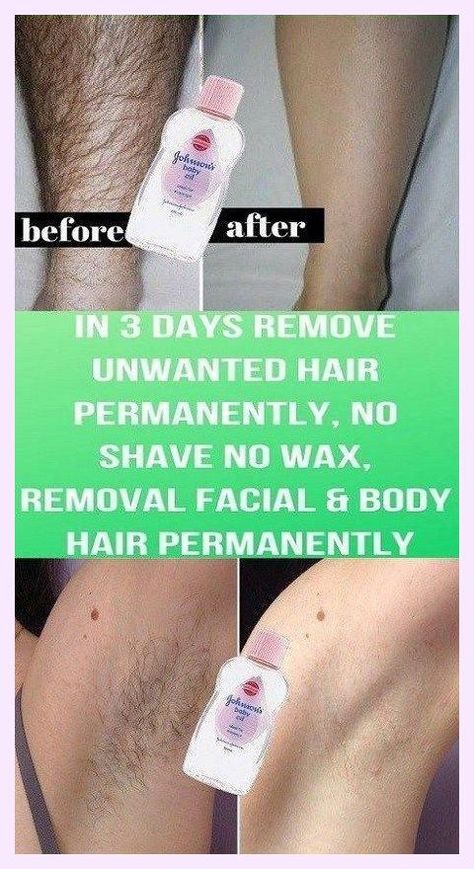 I’m so grateful I get to be here. Laudable info! Best Permanent Hair Removal, Back Hair Removal, Electrolysis Hair Removal, Hair Removal Spray, Unwanted Hair Permanently, Best Hair Removal Products, Underarm Hair Removal, Painless Hair Removal, Unwanted Facial Hair