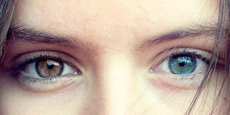 Image result for heterochromia iridum Blue And Amber Eyes Heterochromia, Rare Eye Colors Unique, Eye Claim, Heterochromia Iridum, Heterochromia Eyes, Multi Colored Eyes, Close Up Art, Hazel Eye Makeup, Beautiful Eyes Color