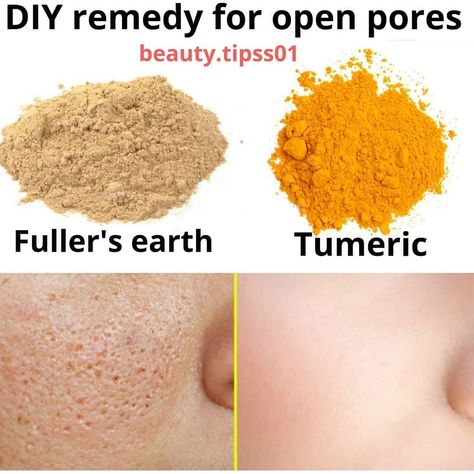 Dark Inner Thighs, Grow Nails Faster, Fullers Earth, Multani Mitti, Homemade Facial Mask, Garden Remedies, Open Pores, Push Up Workout, Homemade Facials