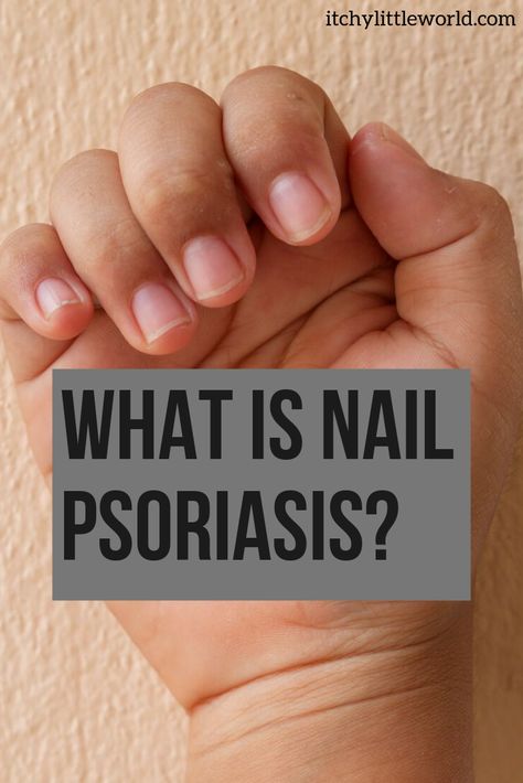 Nail Disorders, Nail Remedies, Nail Problems, Nail Infection, Nail Bed, Ingrown Toe Nail, Toenail Fungus, Nail Fungus, Nail Health