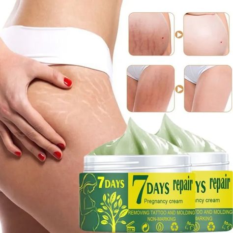 Stretch Mark Removal Cream, Marks Cream, Stretch Mark Cream, Stretch Mark Removal, Acne Scar, Body Creams, Stretch Mark, Amazon Beauty Products, Post Pregnancy