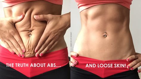 The Truth About Abs & Loose Skin After Pregnancy + Your Ab Questions Answered! Diary Of A Fit Mommy, Mommy Workout, Loose Skin, Body Fitness, Fitness Transformation, Get In Shape, Fitness Diet, Healthy Body, Stay Fit