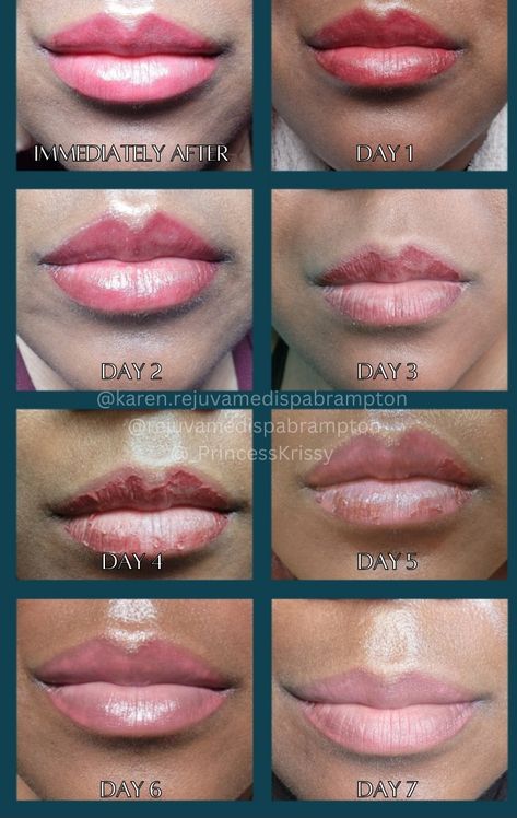 Lipblushing and neutralization on dark skin Lip Blushing Tattoo Before And After Black Women, Lip Neutralization Before And After, Lip Blushing Tattoo Before And After, Lip Neutralization, Lip Blush Tattoo, Blush For Dark Skin, Tattoo Healing Process, Tattoo Healing, Lip Blushing