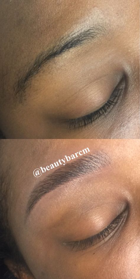 A sparse or missing brow can be completely restored by reshaping it with the 3-Dimensional effect that microblading offers. The results can last anywhere from 1 to 2 years, depending on different factors affecting the procedure. However, a touch up once a year is recommended to retain the shape and saturation of pigment. Eyebrow Tutorial Shaping, Eyebrow Sculpting, Mircoblading Eyebrows, Hair Transplant Women, Ombre Eyebrows, Eyebrow Design, Beautiful Eyebrows, Permanent Makeup Eyebrows, Permanent Eyebrows