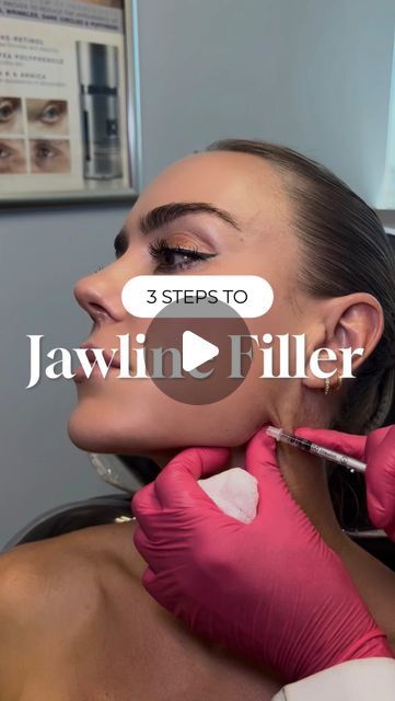 Dr. Kay Durairaj, MD, FACS on Instagram: "A strong, sculpted jawline can transform your entire profile—here’s how we achieve it in just 3 simple steps on gorgeous beauty guru @naventwins! 💛

Step 1: Create angle definition. Injecting filler at the back of the jaw helps to sharpen the angle and lift sagging skin, which instantly improves facial structure. 

Step 2: Address any asymmetries or irregularities. This is done by carefully sculpting along the jawline, ensuring a smooth, even appearance. 

Step 3: Create chin projection. Elongating and refining the chin area helps to balance the lower face and enhance overall symmetry. 

With these steps, the jawline will appear more defined and proportionate without looking overdone!
______________________________
💉: Come see me as a client! Ple Filler Face Lift, How To Sharpen Your Jawline, Jaw Filler Before And After, Face Balancing Fillers, Botox Jawline Before And After, Facial Balancing Filler, Chin Fillers Before After, Jaw Filler, Cheek Injections