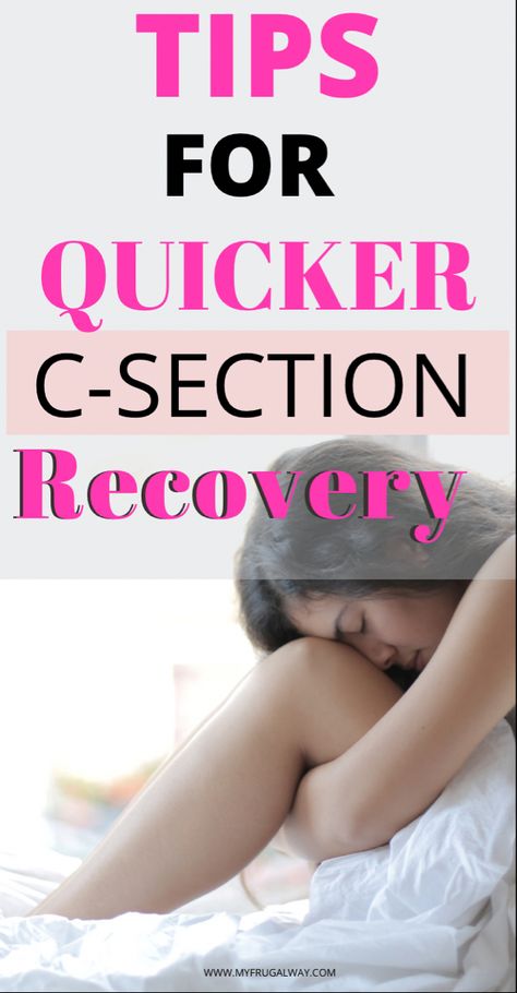 How to quickly recover from a c section, tips I wish I knew prior to my c section. C Section Tips, Postpartum Products, Packing Hospital Bag, C Section Recovery, Best Healthy Diet, Abdominal Surgery, All About Pregnancy, Expecting A Baby, Natural Pregnancy