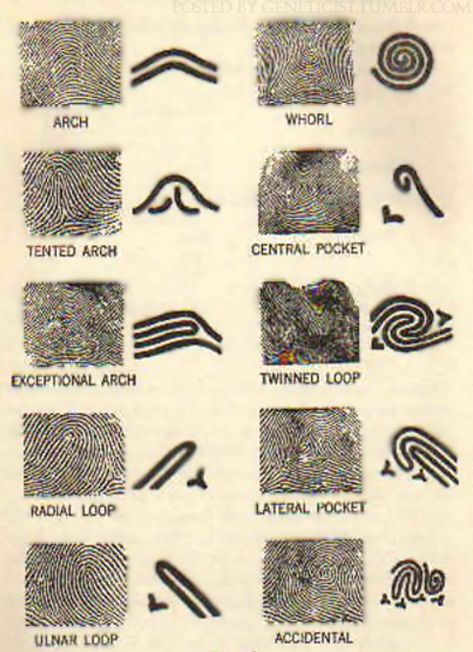 Types Of Fingerprints, Forensic Anthropology, Detective Aesthetic, Forensic Psychology, Forensic Scientist, Forensic Science, Forensic, Science Experiments, Anthropology