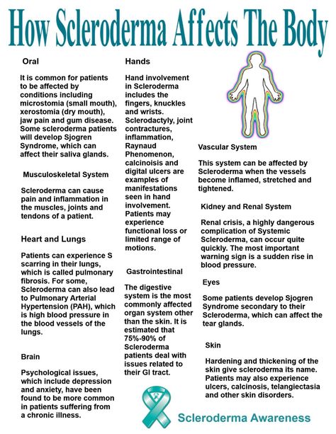 Scleroderma Symptoms, Nursing Knowledge, Scleroderma Awareness, Perioperative Nursing, Sjogrens Syndrome, Jaw Pain, Hand Exercises, Musculoskeletal System, 99 Problems