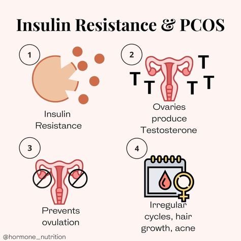 Have you ever wondered how insulin resistance contributes to your PCOS symptoms??  The vast majority of those with PCOS have insulin resistance (estimates up to 75-95%). Just because you dont have elevated blood sugars or a high A1C doesnt mean you arent insulin resistant. In fact usually you are insulin resistant long before your blood sugars start to rise.   Insulin is like the key that lets the sugar in your body get into the cells and give us energy that we need to do everyyything! When this Not Ovulating, Hormone Nutrition, Insulin Resistant, Facial Hair Growth, Pattern Hair, Insulin Resistance, Have You Ever, We Need, Acne