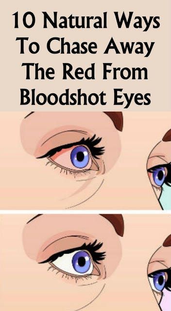 Red Eyes Remedy, Beginner Eyeshadow, Bloodshot Eyes, Lip Color Makeup, Body Organs, Tired Eyes, Cat Makeup, Rose Gold Hair, Lack Of Sleep