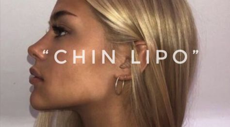 subliminal. double chin. Double Chin Removal Surgery, Double Chin Lipo Before And After, Chin Lipo Before And After, Chin Fillers Before After, Remove Double Chin, Appearance Goals, Lipo Before And After, Cheek Implants, Chin Filler