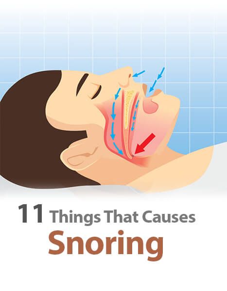 11 Things That Causes Snoring and Their Remedies Natural Snoring Remedies, Snoring Remedies, Snoring Solutions, How To Stop Snoring, Stop Snoring, Dream Symbols, Hair 2024, Back Pain Exercises, When You Sleep