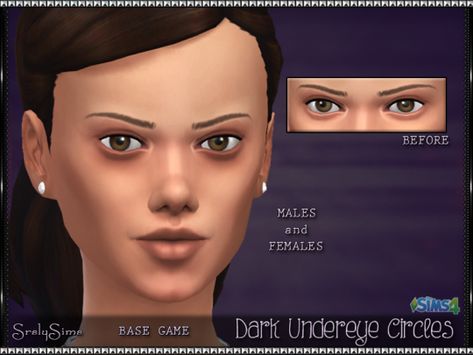 Dark Spots Under Eyes, Dark Undereyes, Dark Undereye, Dark Circle Remedies, Dark Circles Around Eyes, Sims 4 Cc Eyes, Dark Eye Circles, Sleep Deprived, Sims 4 Characters