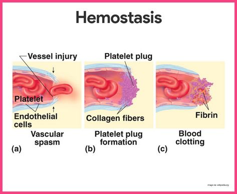 Blood Anatomy and Physiology: Study Guide for Nurses Hemostasis Notes, Blood Anatomy And Physiology, Nursing Infographic, Anatomy And Physiology Study, Studying Hacks, Physiology Study, Tissue Biology, Surg Tech, Associates Degree In Nursing