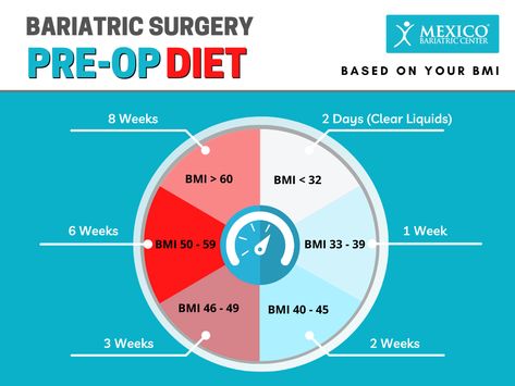 Gastric Bypass Pre Surgery Diet, Pre Op Diet For Sleeve, Pre Op Vsg Diet, Mexico Bariatric Center, Gastric Bypass Recipes Liquid Diet Pre Op, Bariatric Sleeve Pre Op Diet, Bariatric Recipes Pre Surgery, Pre Gastric Bypass Diet, Pre Op Bariatric Diet Meal Plan