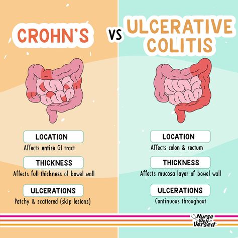 ⭐️ Crohn's vs. Ulcerative Colitis   Inflammatory Bowel Disease (IBD) primarily includes two conditions: Crohn's Disease and Ulcerative Colitis, and understanding the differences between the two as a nursing student is key  🟢 Crohn's Disease:  → Affects entire GI tract → Affects full thickness of bowel wall → Ulcerations can be patchy and scattered (skip lesions)  🔵 Ulcerative Colitis:  → Affects colon and rectum → Affects mucosal layer of bowel wall → Ulcerations are continuous throughout Nursing School Studying Cheat Sheets, Medical Assistant Student, Nursing School Essential, Inflammatory Bowel, Medical School Life, Nursing School Motivation, Nurse Study Notes, Nursing Student Tips, Med School Motivation