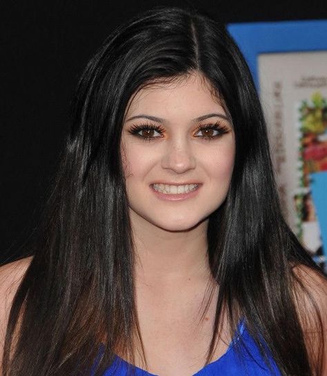 Kylie Jenner Plastic Surgery, Kylie Jenner Icons, Robert Kardashian Jr, Face Fillers, Kylie Jenner Look, Best Lip Gloss, Robert Kardashian, Bruce Jenner, Reconstructive Surgery