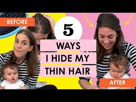 Hide Thinning Hair For Women, Haircuts To Hide Thinning Hair, Hairstyles For Front Thinning Hair, How To Hide Thinning Hair For Women, How To Hide Thinning Front Hair, Postpartum Hairstyles, Thinning Hair Women Hairstyles, Hairstyles For Thinning Hair On Top, Postpartum Hair