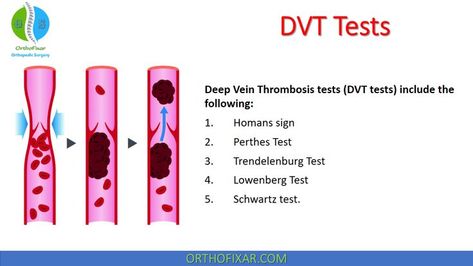 DVT Tests | Deep Venous Thrombosis Diagnosis Homans Sign, Vein Thrombosis, Blood Pressure Cuff, Musculoskeletal System, Orthopedic Surgery, The Patient, Leg Raises, Blood Flow, Quick Saves