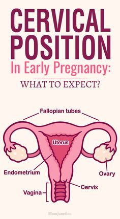 Cervical Position In Early Pregnancy: What To Expect? : The cervical position changes during ovulation through conception and can be an indicator of pregnancy. Also the changes in the cervical mucus can help you check and confirm your pregnancy right at home. Sounds interesting?Read this MomJunction post to know how to check the cervical positions during your fertile window and if this is a reliable method for confirming pregnancy. #healthypregnancy #pregnancy #pregnancycare Checking Cervix For Dilation, Exercise To Dilate Cervix Faster, Fertile Cervical Mucus, Cervix During Ovulation, Cervical Effacement, Pregnancy Kit, Fertile Window, Cervical Mucus, Cervical Traction