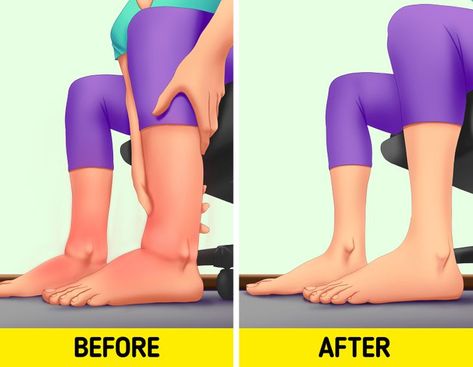 10 Tips for Swollen Legs Your Body Will Thank You For Improve Leg Circulation, Lemon Health, Lymph Drainage Massage, Leg Circulation, Swollen Ankles, Lymph Drainage, Swollen Legs, Leg Cramps, Poor Circulation