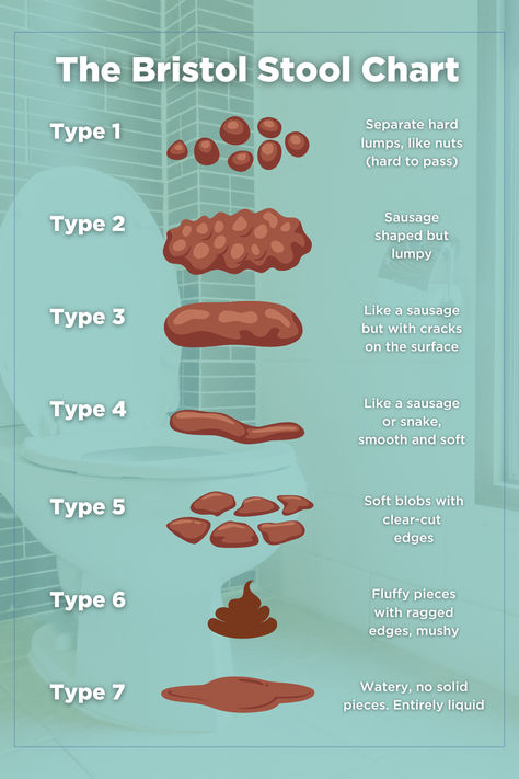 The Bristol Stool Chart is a medical tool that helps classify stool into seven categories based on their shape and consistency. It is used to help diagnose IBS. Find out more about gut health on our website: https://omedhealth.com/insights-hub/ Bristol Stool, Bristol Stool Chart, Stool Chart, Health Conditions, Gut Health, Bristol, Medical, Health