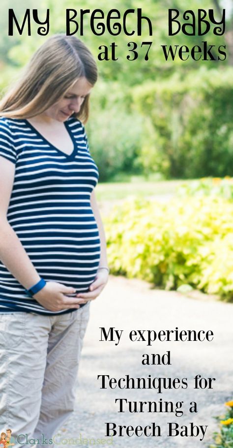 When I was 37 weeks pregnant, we found out our baby was breech. I was determined to do all that I could to get him to turn. Here's my experience and everything you want to know about breech babies - including techniques for turning baby babies! Ecv Procedure Breech Babies, How To Flip A Breech Baby, Breech Baby How To Flip At 37 Weeks, Turn A Breech Baby, Breech Baby, Pregnancy Routine, Breech Babies, 37 Weeks Pregnant, Pregnancy Hacks