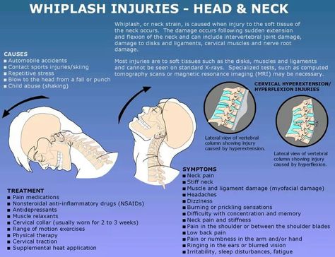 The Triangle’s choice for auto accident injury care. Chiropractic, Acupuncture, Physical Therapy and Nutritional Therapy. www.trianglespinecenter.net Whiplash Injury, Neck Injury, Accident Injury, Back Pain Remedies, Nutritional Therapy, Psoas Muscle, Shiatsu Massage, Massage Benefits, Chiropractic Care