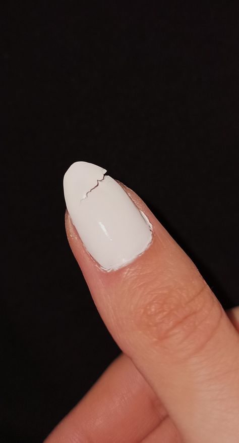 nail
broken nail
nails
nail art
nailart
sad Nails Snap, Neymar Hot, Cute Relationship Pictures, Broken Nails, Ginger Hair Color, Nail Pictures, Casual Indian Fashion, Broken White, Nail Photos