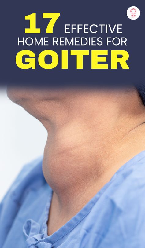 17 Effective Home Remedies For Goiter: Goiter is characterized by swelling of the thyroid gland. Though this condition may appear to be a frightening illness, you can easily treat it with the right combination of medical care and home remedies. Healthy Pantry Staples, Home Remedies For Bronchitis, Iodine Deficiency, Longevity Diet, Healthy Pantry, Natural Headache Remedies, Natural Sleep Remedies, Thyroid Gland, Cracked Heels