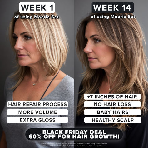 🖤Black Friday Blowout!🖤 Want longer, thicker, and fuller hair?  This is IT! You get all that and even more: 🤯 60% Off your entire order 🤯 Free Gift  🤯 Free shipping  💖Your best hair ever in 30 days! Why wait? spray.moerie.com/?flow=bf Scalp Hair Growth, Hair Growth Products, Free Quiz, Fuller Hair, Hair Product, Sls Free Products, December 2024, Healthy Scalp, Product Recommendations