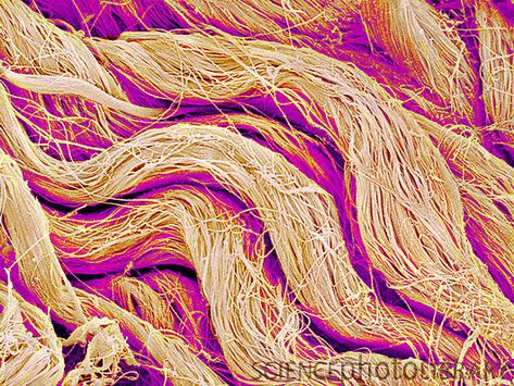 Collagen fibres. Coloured scanning electron micrograph (SEM) of collagen from the dermis of the skin. Collagen is a protein with a high tensile strength. Anatomy Images, Scanning Electron Microscope, Scanning Electron Micrograph, Integumentary System, Microscopic Photography, Cells And Tissues, Collagen Fibers, Microscopic Images, Electron Microscope