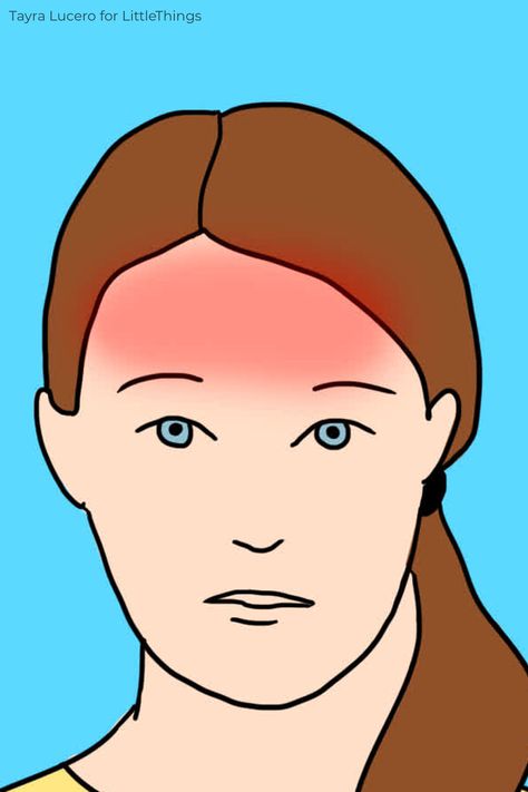 Forehead Headache, Headache Meaning, What Causes Headaches, Different Types Of Headaches, Blood Sugar Tracker, Headache Causes, Throbbing Headache, Constant Headaches, Low Estrogen Symptoms