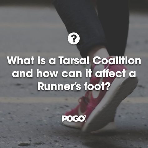 What is a Tarsal Coalition and how can it affect a Runner’s foot? Tarsal Coalition, Gold Coast, How Can, Bones, Running, Canning, Gold