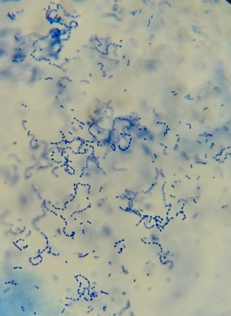 Lactobacillus Bacteria, Lactobacillus Acidophilus