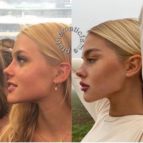 How To Get A Sharp Jawline Women, Sharp Jawline Aesthetic, Jawline Surgery, Model Jawline, Model Nose, Jawline Filler, Public Piano, Nose Plastic Surgery, Sharp Jawline