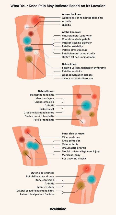 Physical Therapy For Knee Pain, Knee Pain Exercises Physical Therapy, Knee Exercises For Pain, Meniscus Pain Relief, Back Of Knee Pain, Pain Behind The Knee, Exercise For Knee Pain, Stretches For Knee Pain, Medial Knee Pain