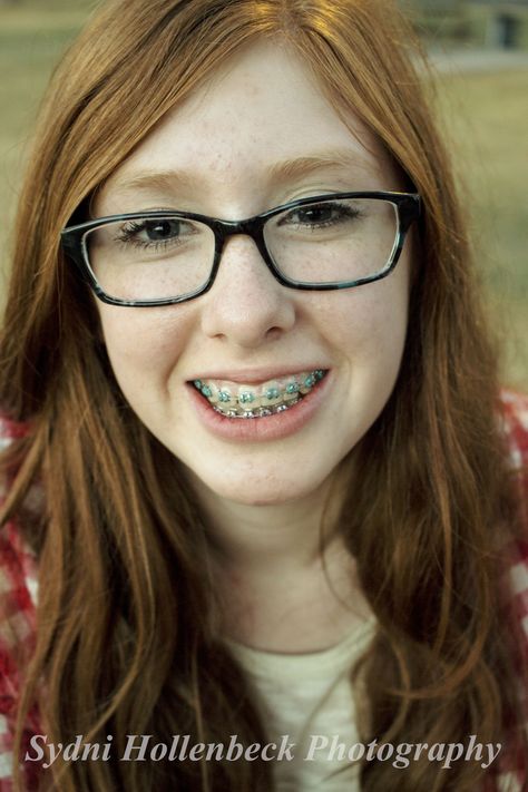 Braces And Glasses, Girls With Braces, Embarrassing Photos, Adult Braces, Wedding Party Robes, Braces Girls, Orthodontic Appliances, Cute Braces, Lil Girl Hairstyles