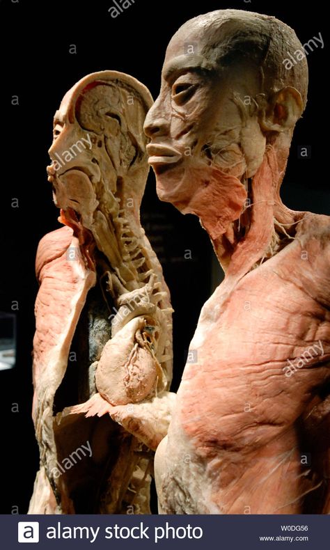 Download this stock image: A dissected human specimen is on display at Bodies...The Exhibition, at The Dome in Rosslyn, Virginia on April 12, 2007. Bodies showcases real, whole and partial body specimens that have been donated and then specially preserved. (UPI Photo/Kevin Dietsch) - W0DG56 from Alamy's library of millions of high resolution stock photos, illustrations and vectors. Body World Exhibition, Animals With Human Bodies, Human Body Exhibit, Bodies Exhibit, Body Horror Sculpture, Anatomy Practice, Body Scanning, April 12, The Exhibition