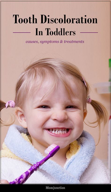 Does your toddler have yellow or gray teeth? Did you know tooth discoloration is one of the top dental issues ? Read more on tooth discoloration in toddlers Toddler Tooth Decay, Black Teeth, Discolored Teeth, Kids Teeth, Dental Cavities, Teeth Health, Parenting Inspiration, Oral Care Routine, Stained Teeth